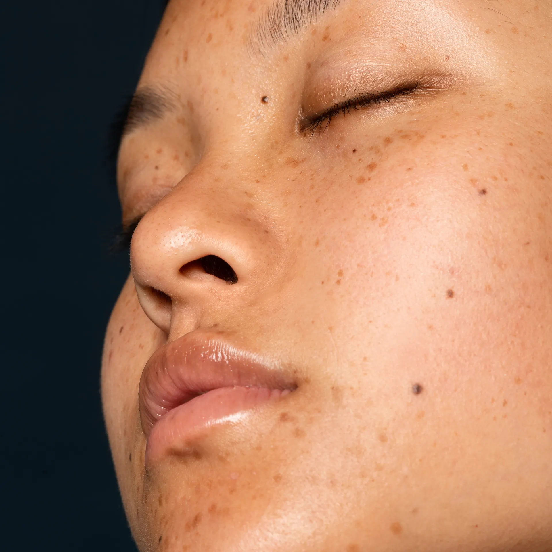 The Best Ingredients for Dark Spots