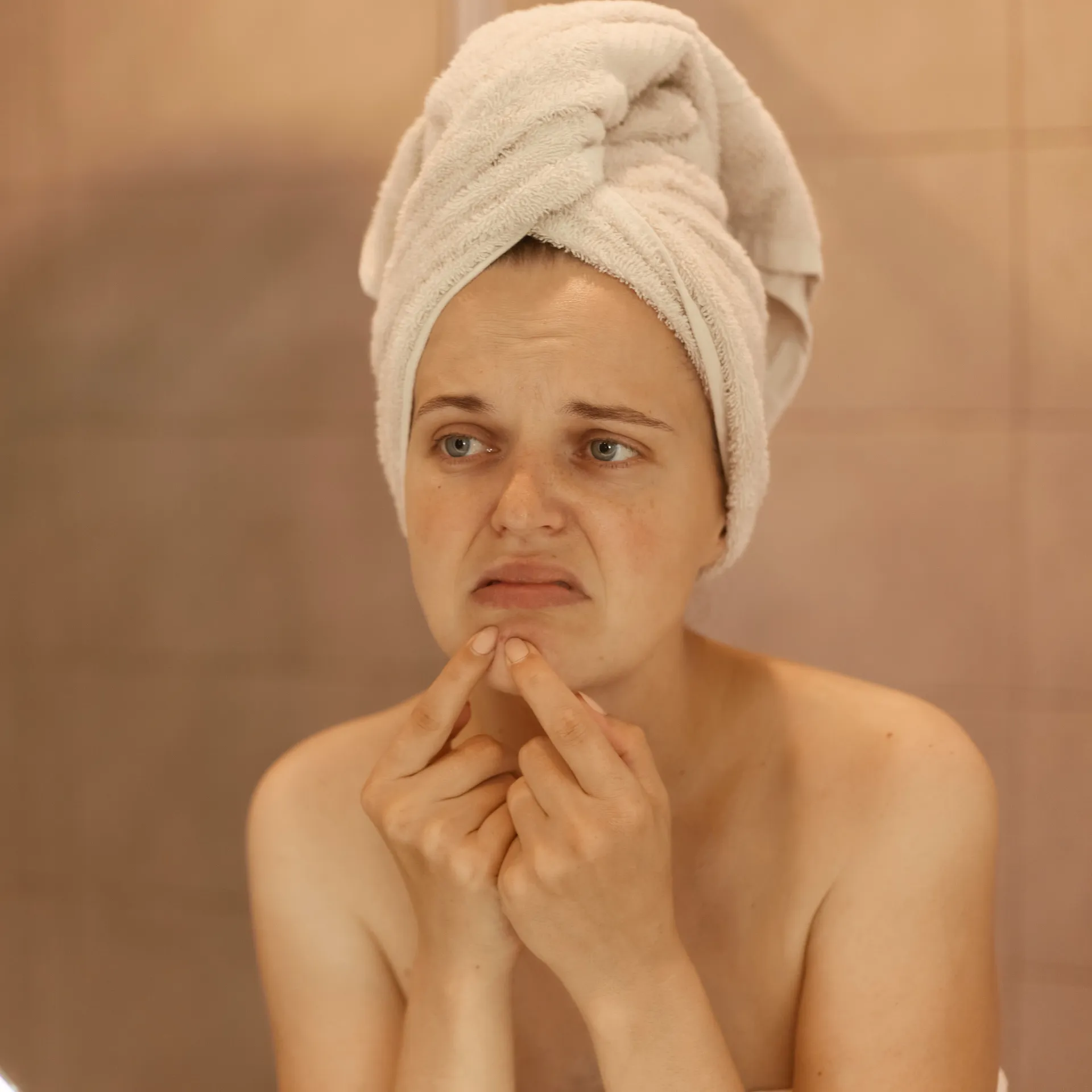 Acne Mapping: What Your Breakouts Mean